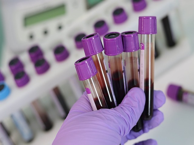 SARS-CoV-2 Antikorunu 10 Dakikada Tespit Eden Hassas Test