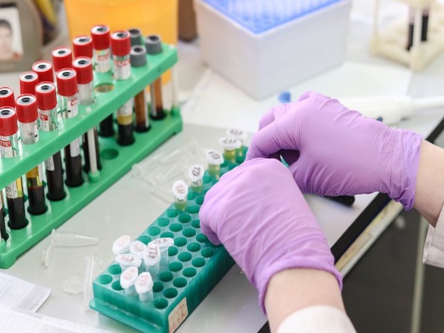 ABD'de Bir İlk: Evlerde Uygulanabilen Koronavirüs Testi