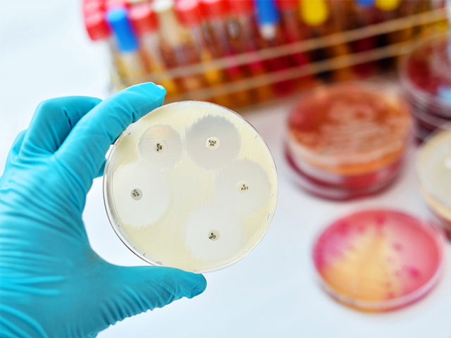 Hızlı Antibiyotik Duyarlılık Testi için Empedans Sitometrisi