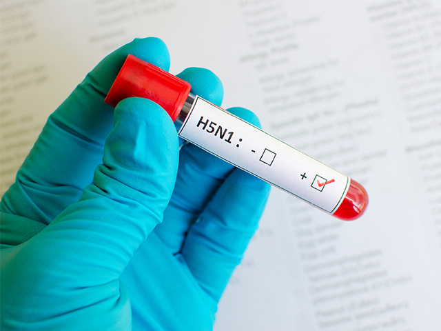 Avustralya'da 2 Yaşındaki Kız H5N1 Kuş Gribine Yakalandı