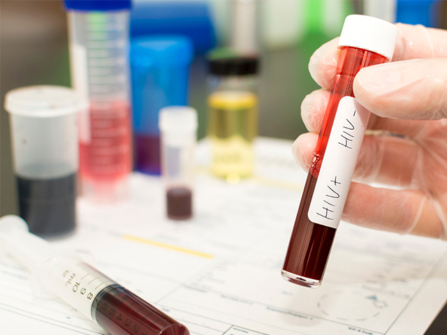 Araştırmacılar HIV Replikasyon İnhibitörünün Toplam Sentezini Yaratıyor