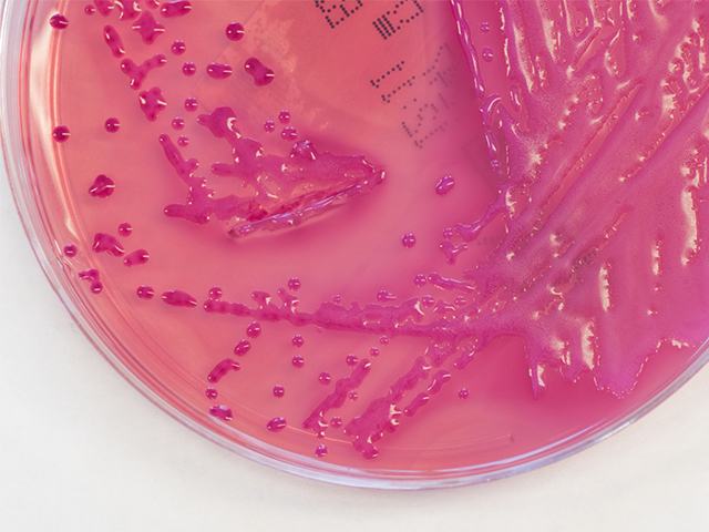 Klebsiella Enfeksiyonlarına Hastanelerde Doğadan Daha Sık Rastlanıyor