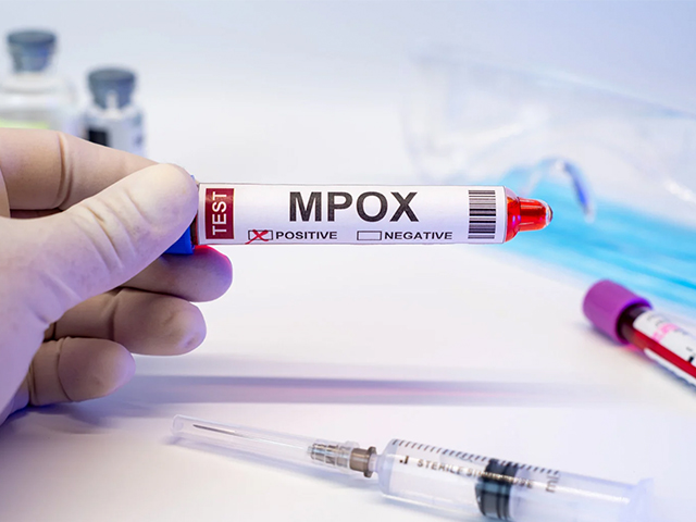 Avrupa’da Yeni Mpox Vakaları: Uzmanlardan Aşı Uyarısı