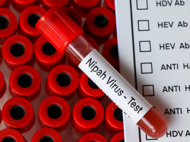 Hindistan’da Bir Çocuğun Nipah Virüsünden Ölmesinin Ardından Alarm Verildi