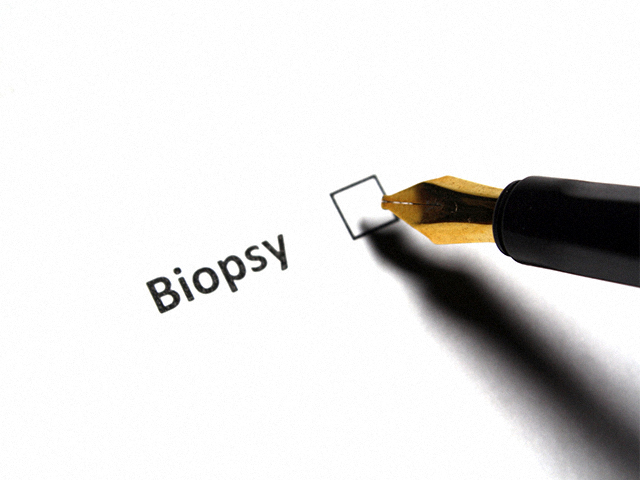 Sağlıklı Dokular Arasındaki Tümörleri Saptamak için Optik Biyopsi