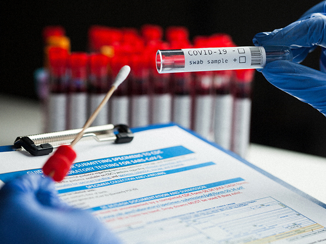 90 Dakikalık PCR Testi için Ortaklık