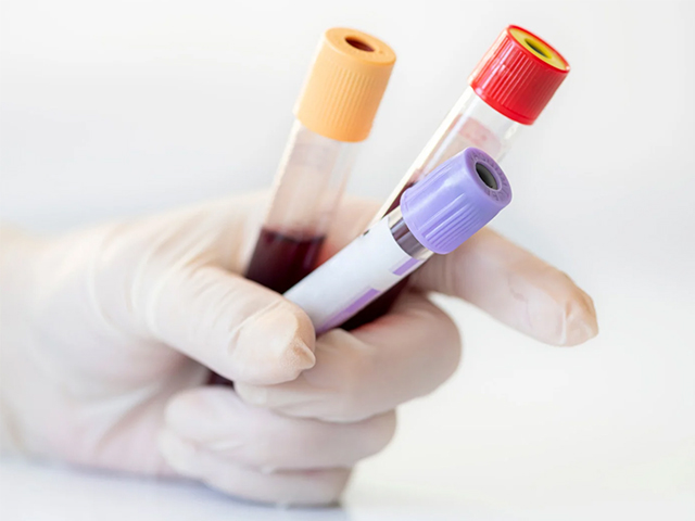 Parkinson Kan Testi Erken Teşhis Umudu Veriyor