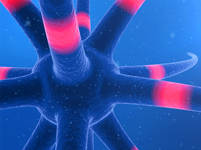 Kötü İzole Edilmiş Sinir Hücreleri Yaşlılıkta Alzheimer Hastalığını Teşvik Ediyor