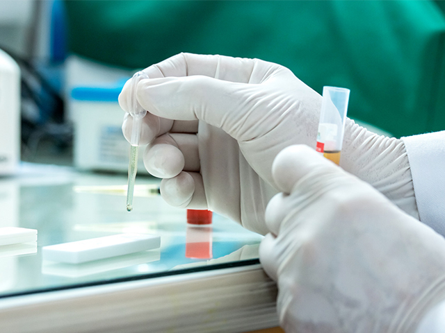 Otomatikleştirilmiş Yeni Hızlı Viral Test Kiti