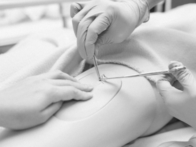 Tendondan Esinlenen Sütürler Kırılgan Dokuları Koruyor