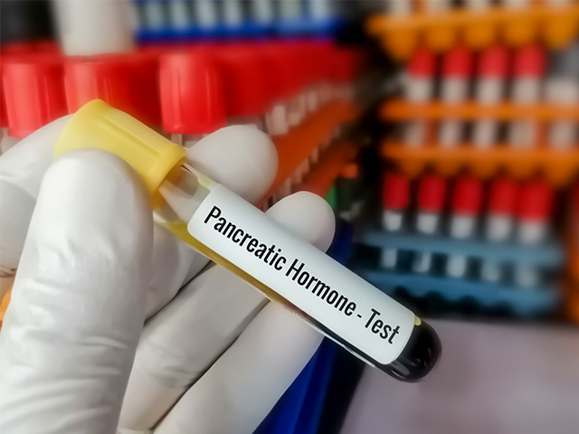 Pankreas Kanseri için Deneysel Kan Testi Doğrulama ve Geliştirme Aşamasında