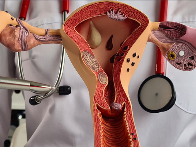 NHS Tarafından Onaylanan Yeni Endometriyal Kanser İmmünoterapisi