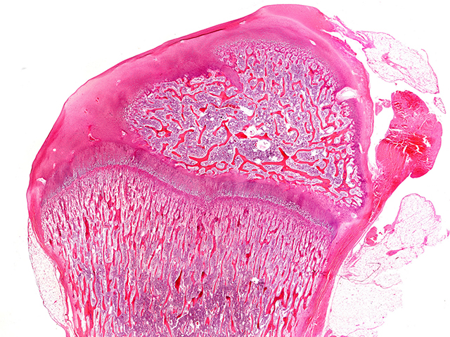 YAP ve TAZ: Fetal Kemik Gelişimi için Protein Ortakları