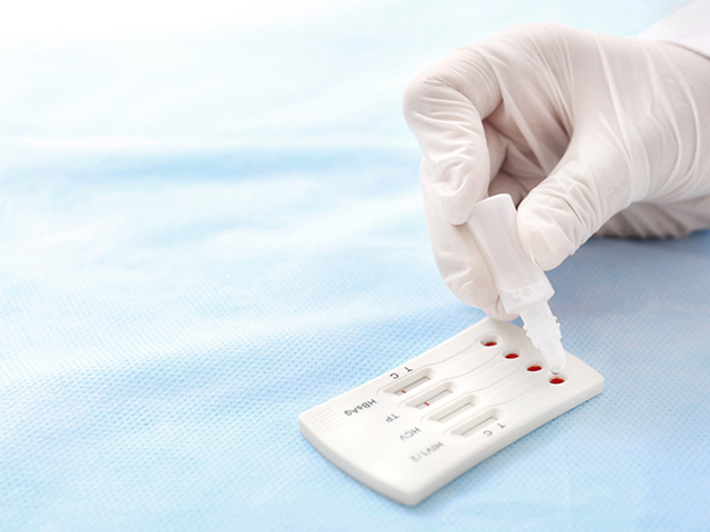 Bilim İnsanları Hem HIV Hem de TB için Hızlı Test İcat Etti