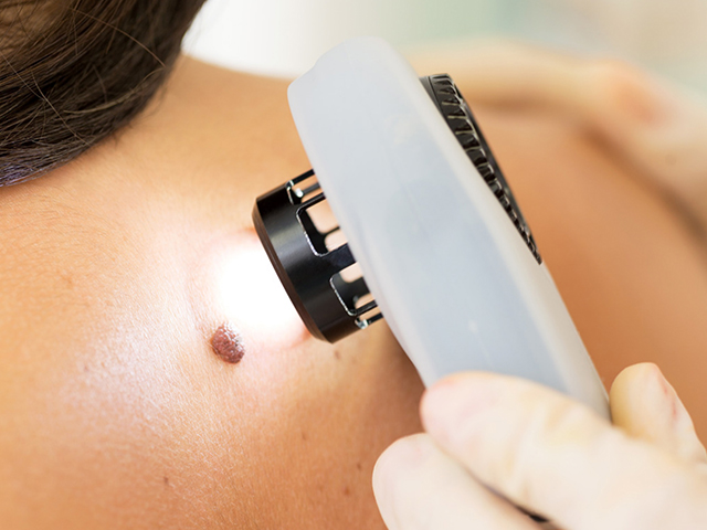 ARM-002TM Anti-Kanser Aşısı Önceden Belirlenmiş Melanomla Mücadelede Umut Vaat Ediyor