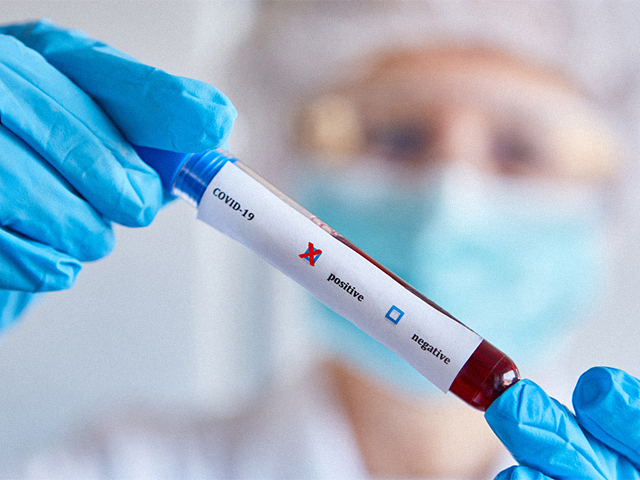 NIRVANA Testi COVID-19 Viral Varyantlarını Hızla Tanımlıyor