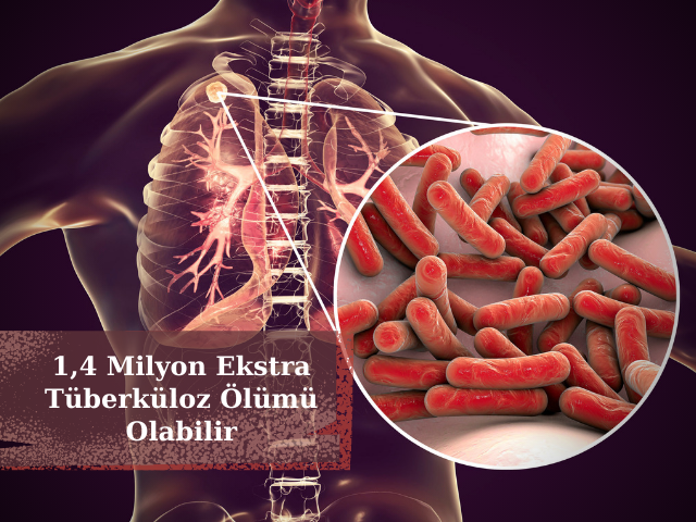 Koronavirus Kısıtlamaları 1,4 Milyon Ekstra Tüberküloz Ölümünü Tetikleyebilir
