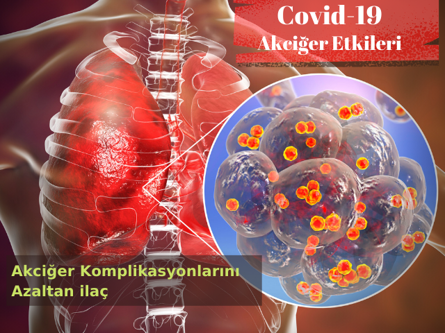 Yeni İlaç Akciğer Komplikasyonlarını Önemli Ölçüde Azalttı