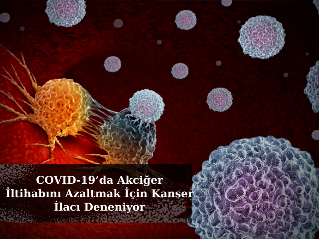 COVID-19’da Akciğer İltihabını Azaltmak İçin Kanser İlacı Deneniyor