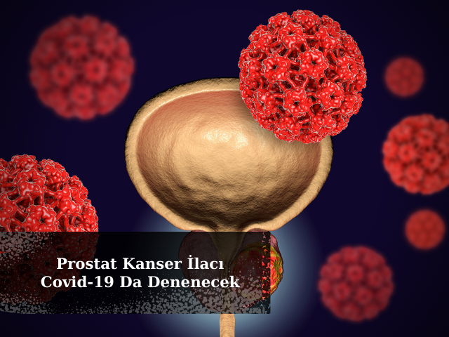 Prostat Kanser İlacı Covid-19 Da Denenecek
