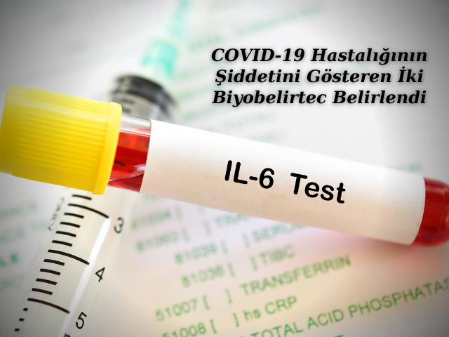 COVID-19 Hastalığının Şiddetini Gösteren İki Biyobelirtec Belirlendi