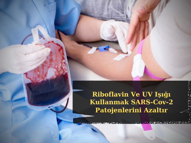 Kan Ürünlerinde Riboflavin Ve UV Işığı Kullanmak SARS-Cov-2 Patojenlerini Azaltır
