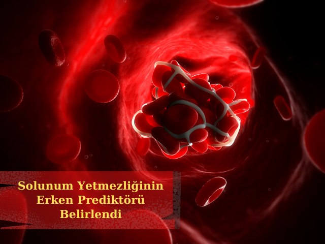 COVID-19'lu Hastalarda Şiddetli Solunum Yetmezliğinin Erken Prediktörü Belirlendi