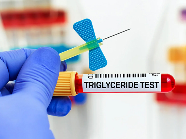 Kalbin Gizli Düşmanı Trigliserid